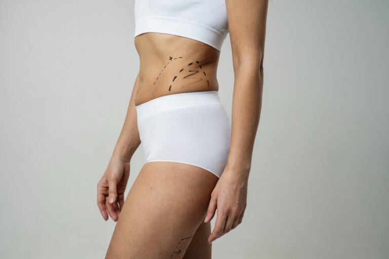 Liposuction’s Next Chapter: Why More Patients Are Turning to Laser-Based Body Contouring